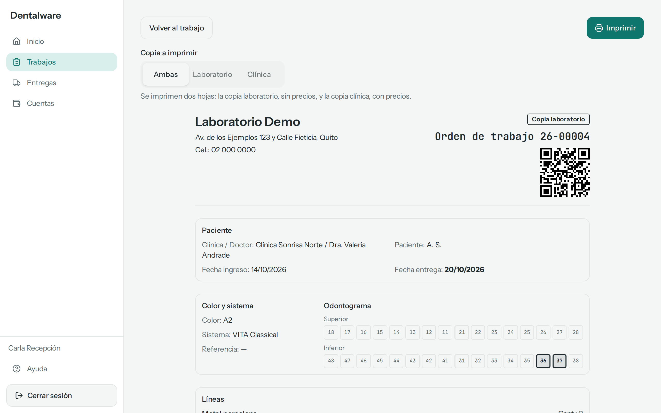 Orden de trabajo 26-00004: los botones Volver al trabajo e Imprimir, la elección de copia y la copia laboratorio con el código QR